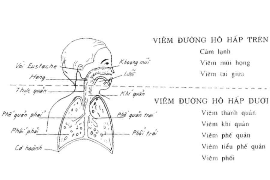 Các bệnh nhiễm trùng đường hô hấp trên thường gặp nhất